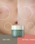 Essenherb Tea Tree Soothing In Calming Cream (80ml) - AMI Cosmetic