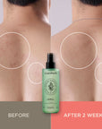 Essenherb Tea Tree 90 Clear Body Mist (200ml) - AMI Cosmetic