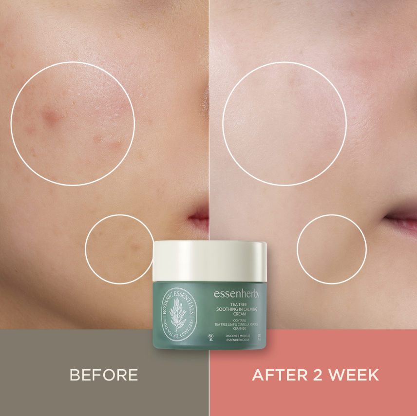 Essenherb Tea Tree Soothing In Calming Cream (80ml) - AMI Cosmetic