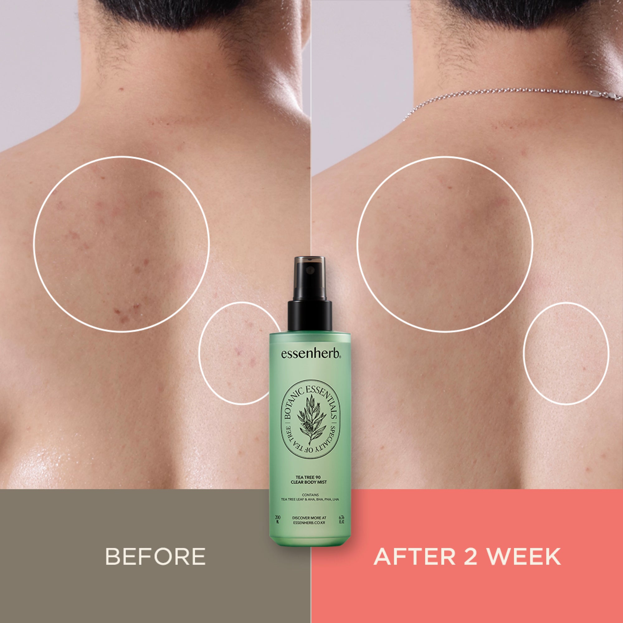 Essenherb Tea Tree 90 Clear Body Mist (200ml) - AMI Cosmetic