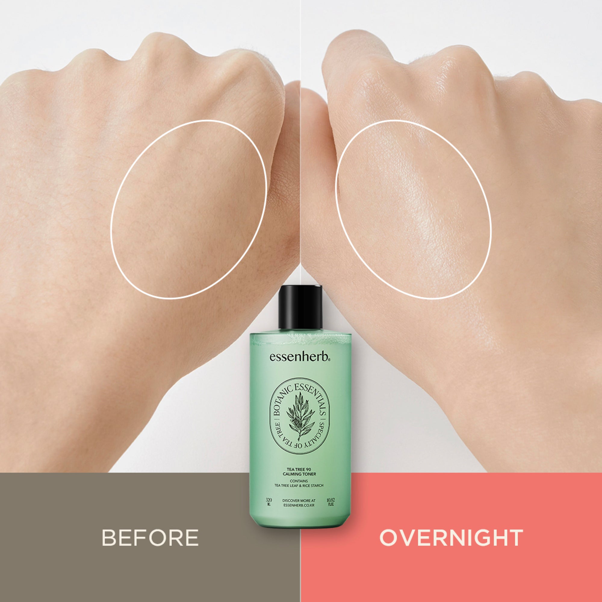 Essenherb tea tree 90 calming toner - AMI Cosmetic